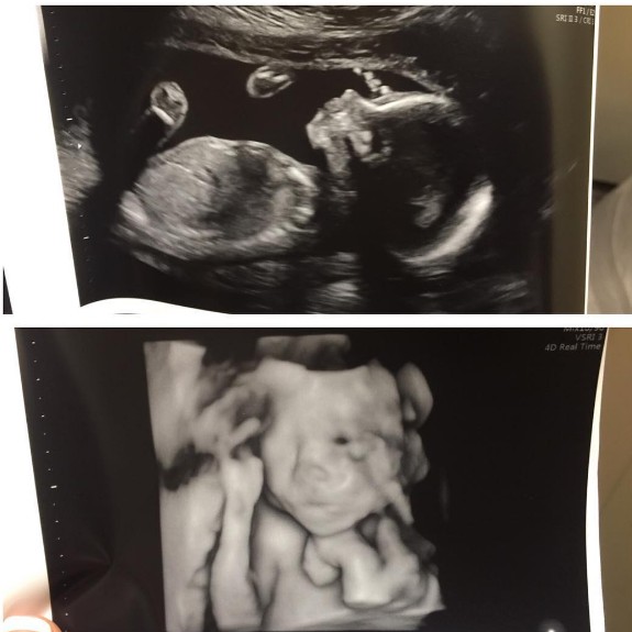 Jenelle Evans Baby Bump and Sonogram