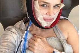 Yolanda Hadid Gets Dental Surgery In Lyme Fight
