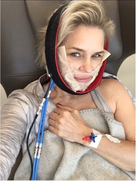 Yolanda Hadid Gets Dental Surgery In Lyme Fight