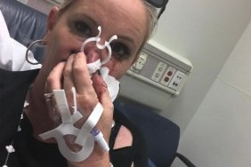 Shannon Beador Nosebleed - Rushed to hospital