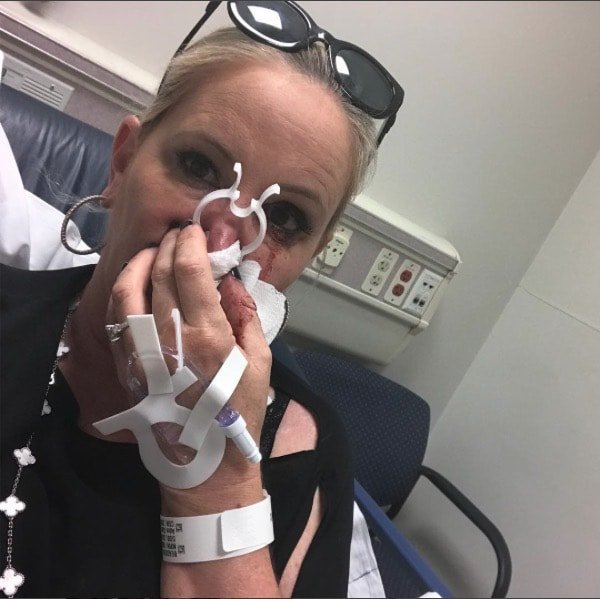 Shannon Beador Nosebleed - Rushed to hospital