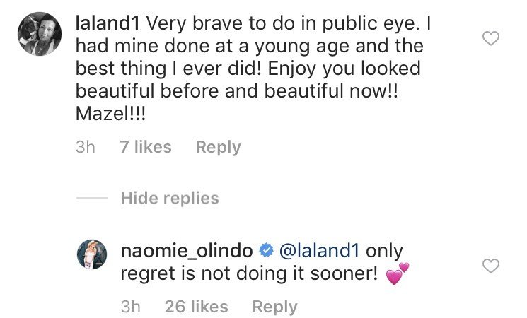 Southern Charm’s Naomi Olindo Admits She Got A Nose Job