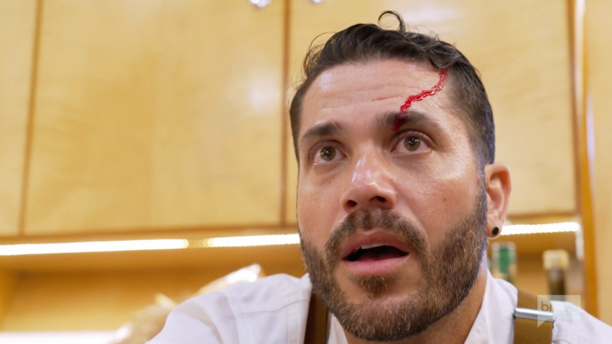 below deck sailing yacht recap season 3 episode 4 chef marcos spaziani scalped blood injury bleeding