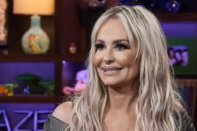 PHOTOS - Shocking Taylor Armstrong Abuse Photos Released - Reality Tea