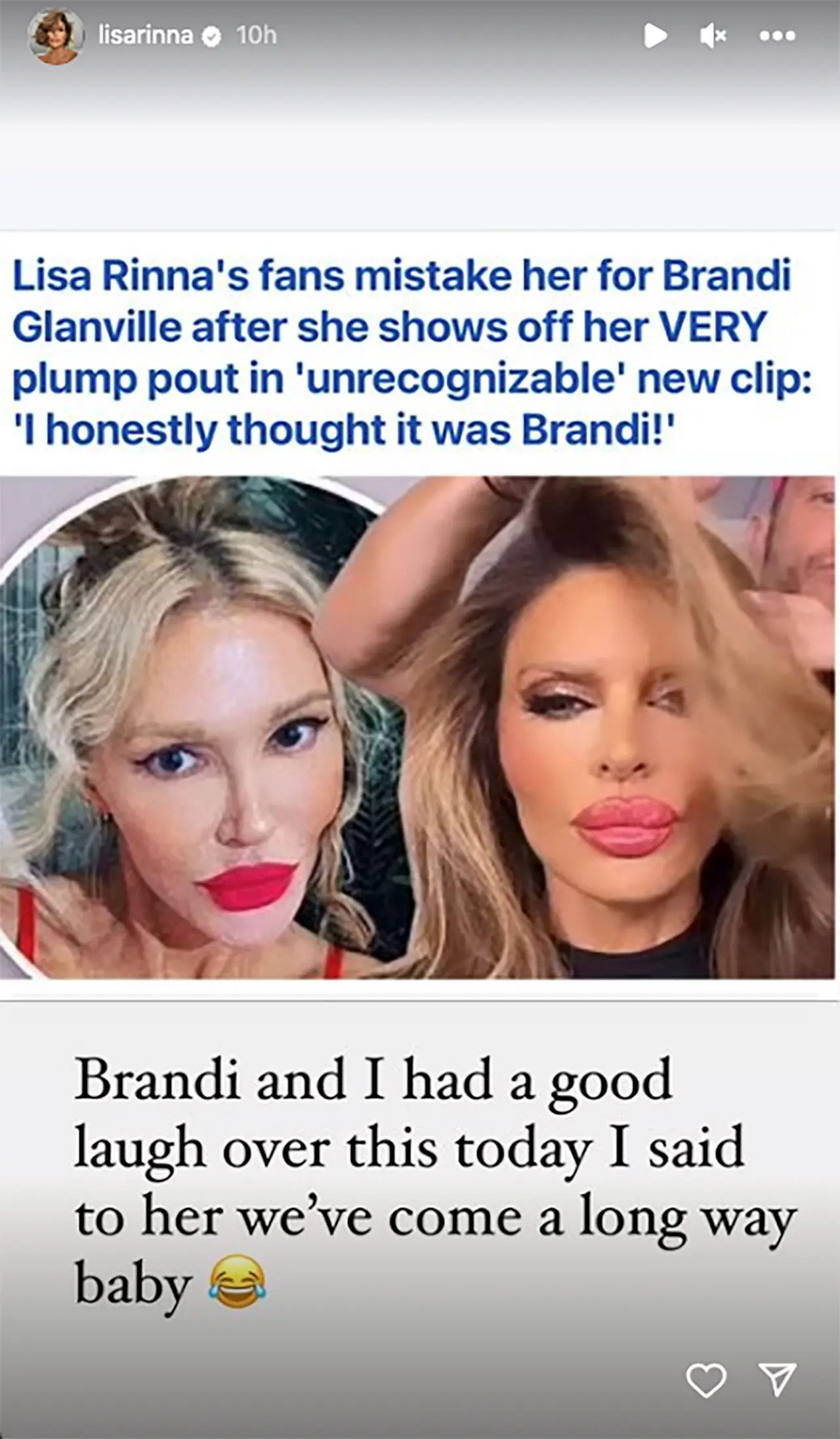 Lisa Rinna and Brandi Glanville Laughed Over Comparisons