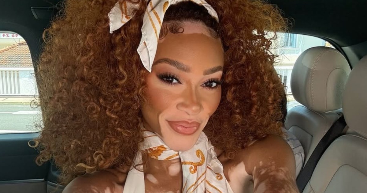 Fans Call Winnie Harlow in Two-Piece Sauna Outfit ‘Sensational’