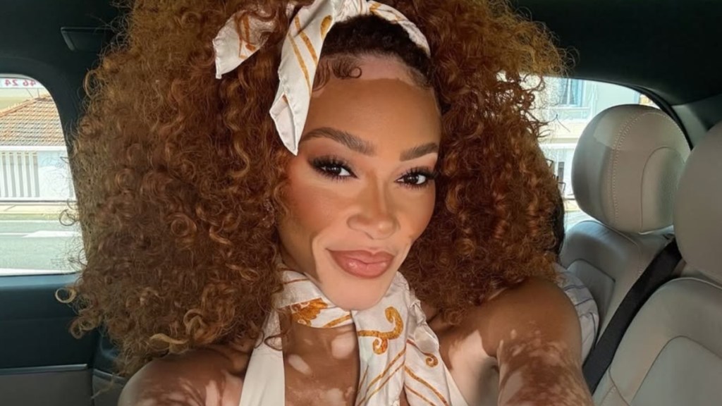 Fans Call Winnie Harlow in Two-Piece Sauna Outfit 'Sensational'