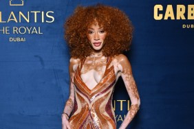 Fans Are ‘Obsessed’ With Winnie Harlow in Brown Daring Maxi Dress
