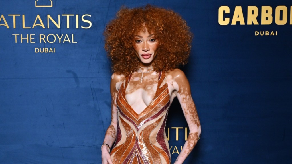 Fans Are ‘Obsessed’ With Winnie Harlow in Brown Daring Maxi Dress