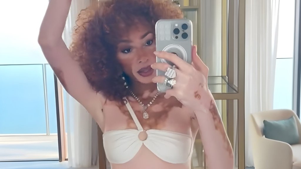 Fans React to Winnie Harlow in Tiny White Two-Piece: ‘Body Is the Finest of Teas'