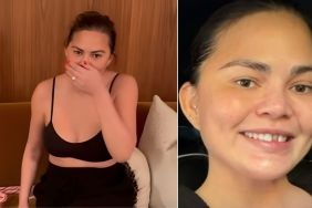 Chrissy Teigen's Tooth Falls Out in Christmas Video