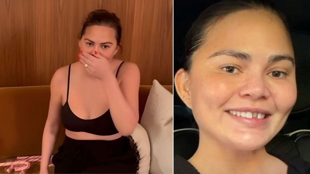 Chrissy Teigen's Tooth Falls Out in Christmas Video