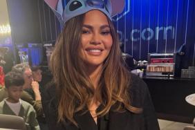 Chrissy Teigen’s Tooth Doesn’t Look the Way It Used to Anymore