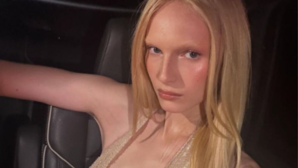 Alex Consani’s Micro Minidress Is a Little Too Tiny & Basically a Coat