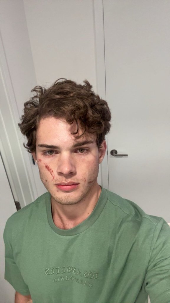 Clavicular via his Twitter 