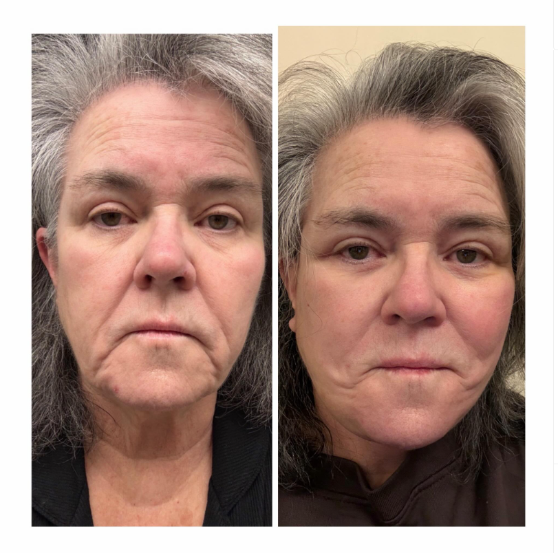 Rosie O'Donnell
