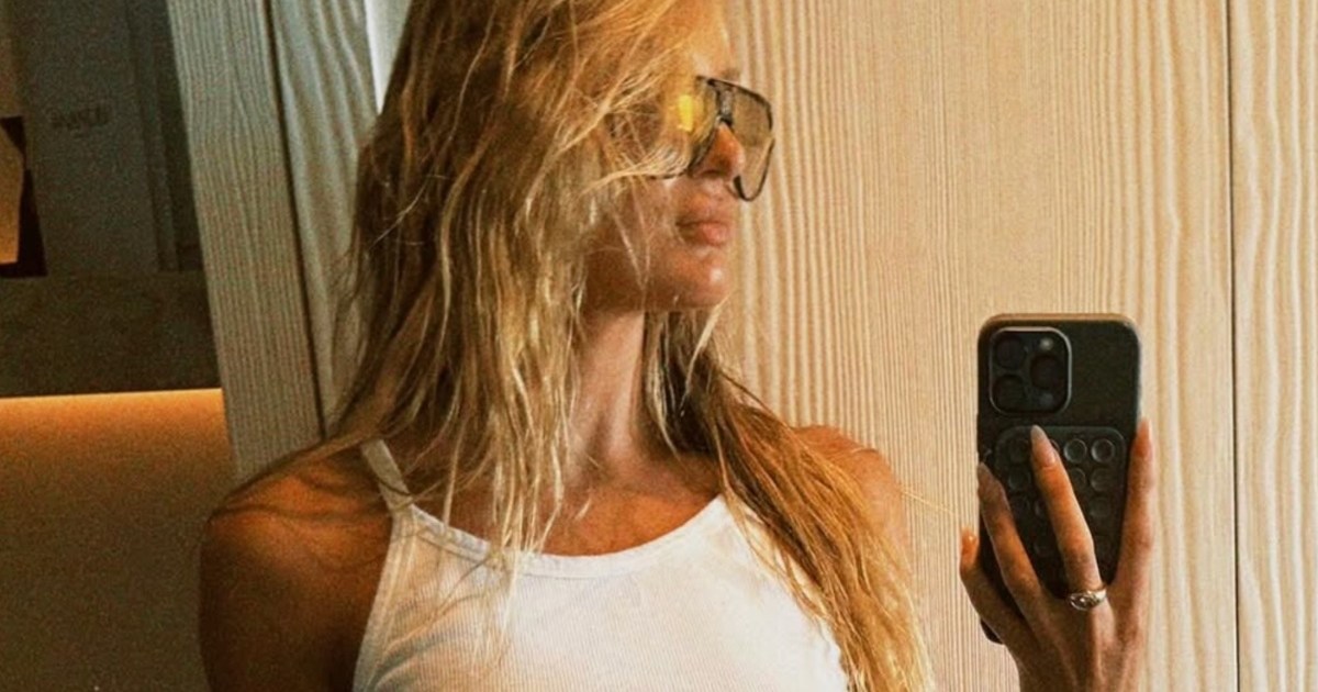 Candice Swanepoel’s Peeking Top Almost Overshadows Her Leg-Baring Mini Skirt