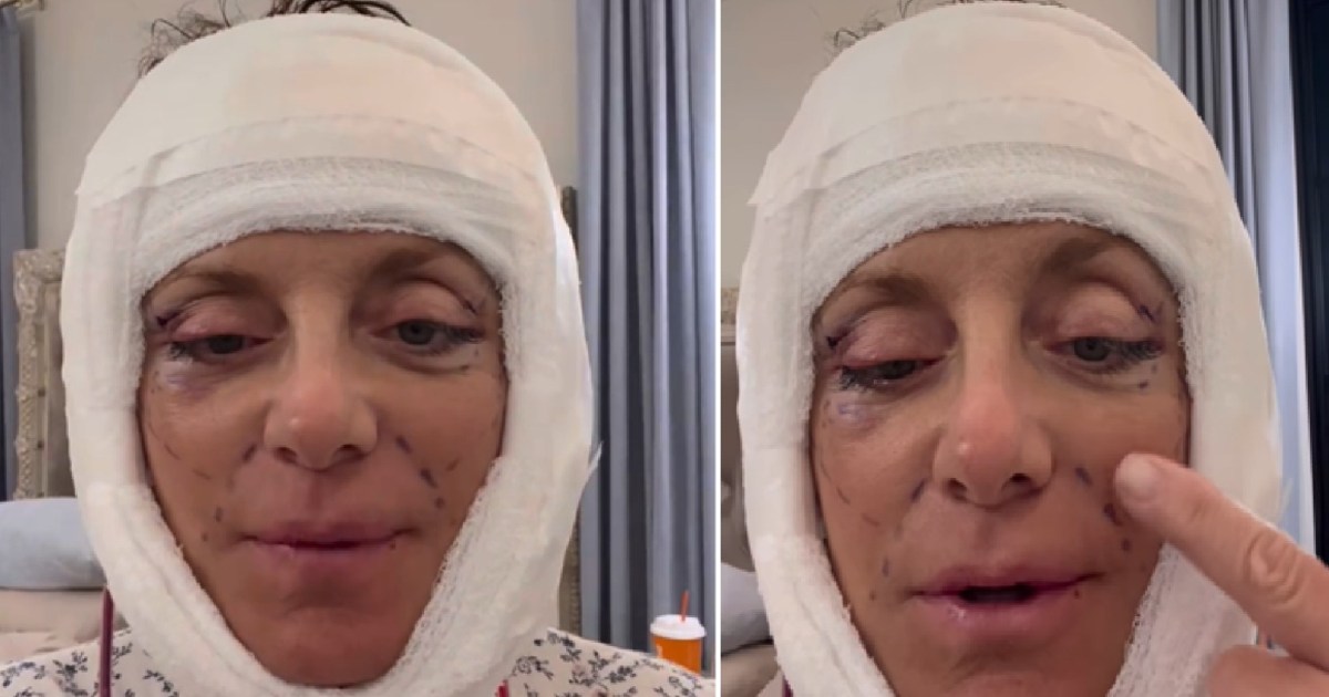 RHONJ Alum Kathy Wakile Shocks Fans With Bandaged Face:&hellip;