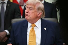 Donald Trump’s Hand Makeup Could Not Hide Bruise in New NATO Photos