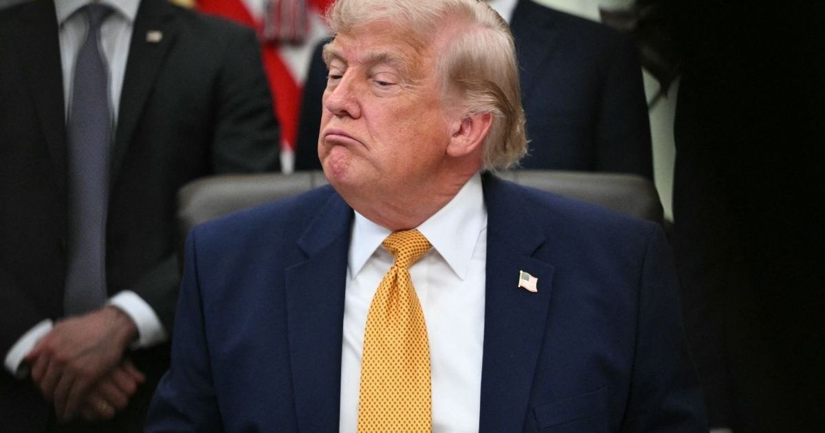 Donald Trump's Hand Makeup Could Not Hide Bruise in New NATO Photos