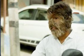 Teen With ‘Werewolf Syndrome’ Praises Barber Who Helped Him Feel Accepted