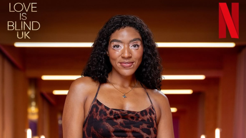 Yasmin Toseafa opens up about revealing her vitiligo on Love Is Blind: UK